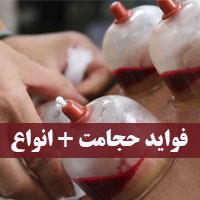 حجامت عام چیست + چه فوایدی دارد