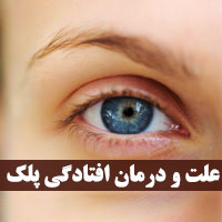 افتادگی پلک چشم با ۳۷ علت و راه های درمان با تصاویر