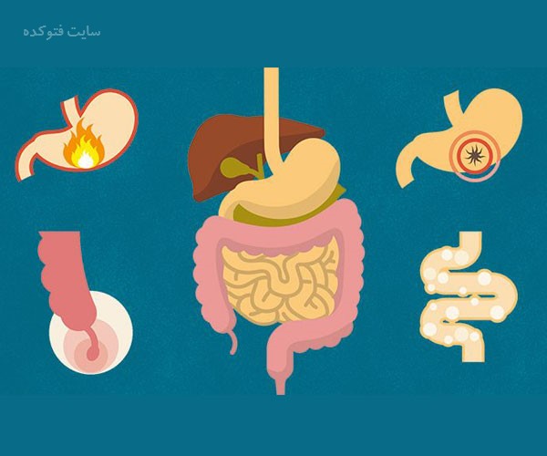 بیماری های شایع عملکردی دستگاه گوارش در زنان و مردان