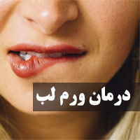 درمان ورم لب در خانه با طب سنتی