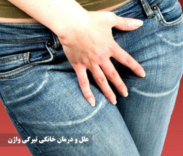رفع تیرگی واژن با جوش شیرین و طب سنتی در خانه