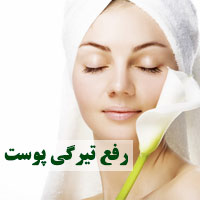 تیرگی پوست و روش های درمان خانگی