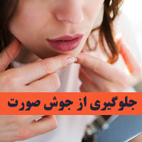 جلوگیری از جوش صورت + ۱۵ توصیه برای کاهش جوش