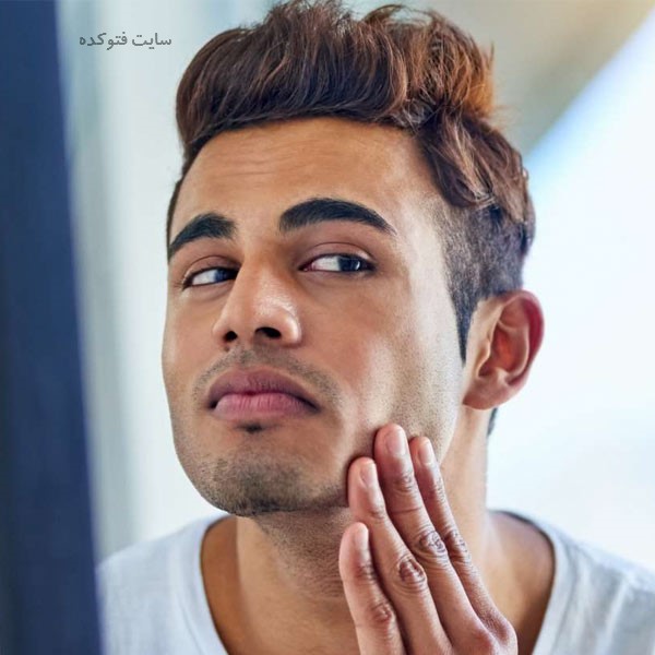 جلوگیری و کنترل جوش زدن صورت