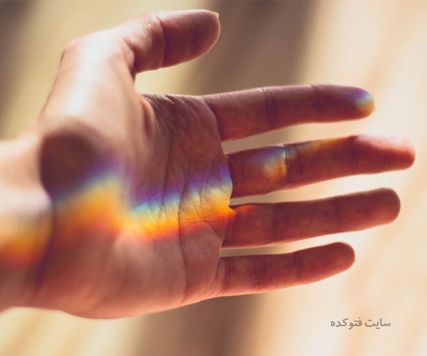 علت خارش کف دست نشانه چیست
