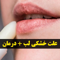 خشکی لب نشانه چیست + ۱۷ علت و درمان خشکی لب