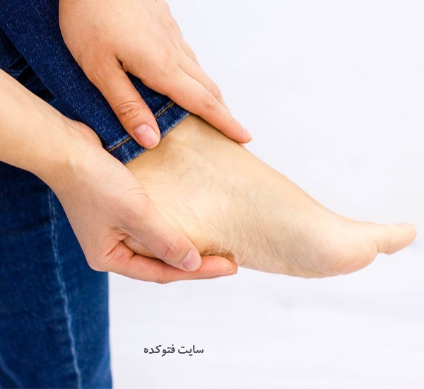 درد پاشنه ی پا نشانه چیست