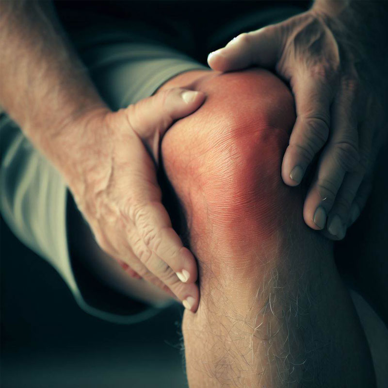 نشانه های آرتروز زانو چیست و راه و روش درمان اصولی در خانه