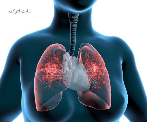 بهترین راه و روش پاکسازی ریه ها