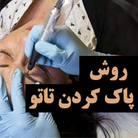 روش های پاک کردن تاتو در خانه + 22 روش از بین بردن تاتو