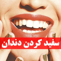 سفيد كردن دندان ها در خانه با طب سنتی