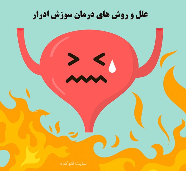 سوزش ادرار در زنان و مردان نشانه چیست