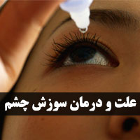 سوزش چشم با ۳۲ علت و روش های درمان (جدید)