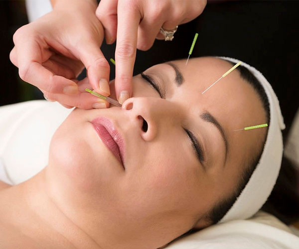 طب سوزنی چیست با عکس ها