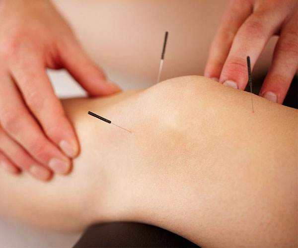 طب سوزنی چه بیماریهایی را درمان میکند