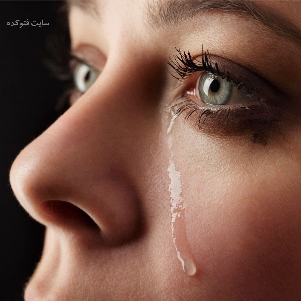 رفع آب ریزش از چشم