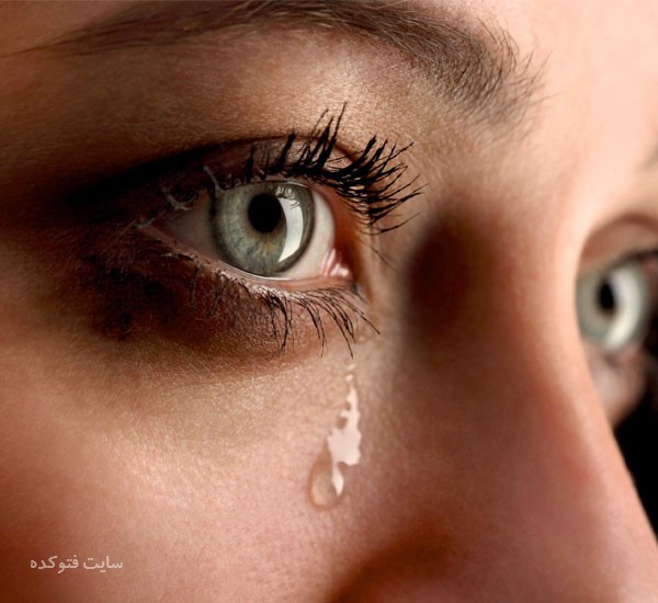 آب ریزش چشم نشانه چیست