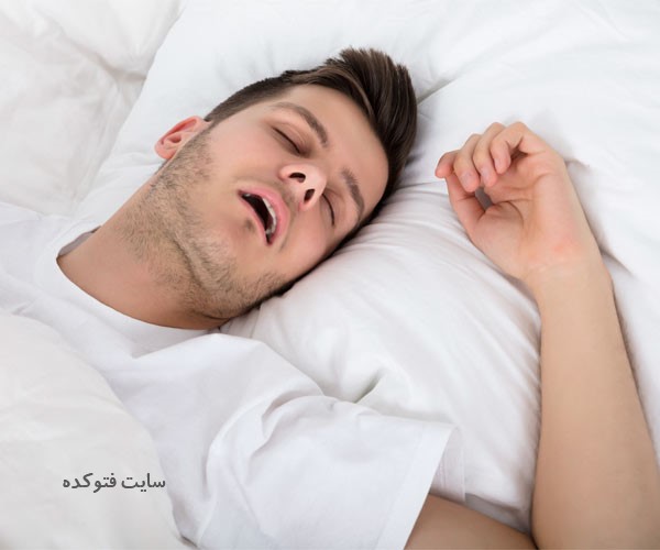 علت باز ماندن دهان در خواب
