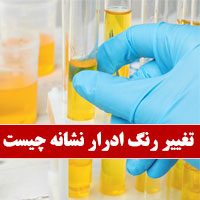 علت تغییر رنگ ادرار نشانه چیست با علت یابی از روی رنگ