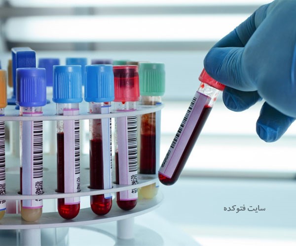 عکس رنگ ادرار نشانه چیست