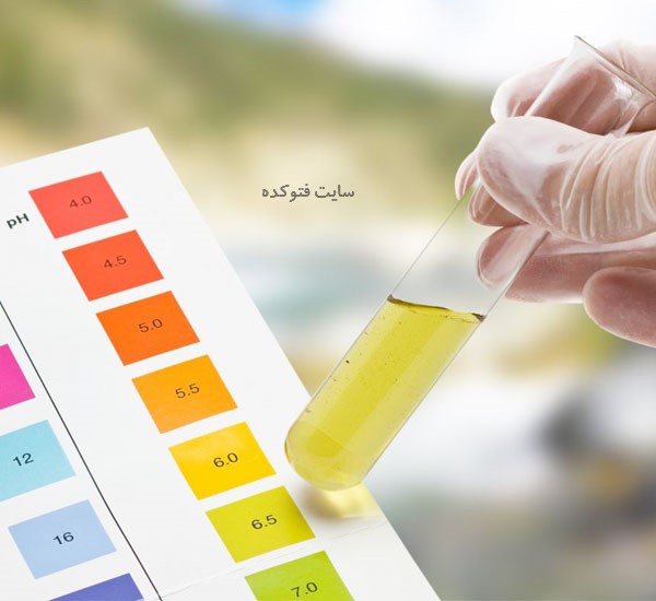 عکس تغییر یافتن رنگ ادرار نشانه چه بیماری است