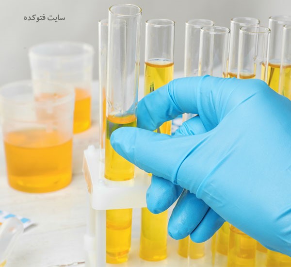 عکس رنگ زرد در ادرار نشانه بارداری است ؟