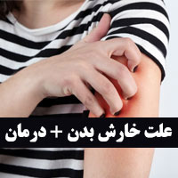 علت خارش بدن | بهترین راه های درمان خارش بدن در شب