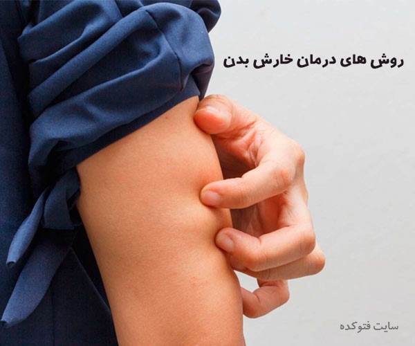 درمان خارش دست و پا با روش های علمی و سنتی