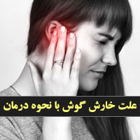 علت خارش گوش و روش درمانی (۲۲ مورد) در منزل