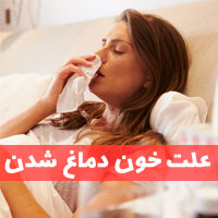 علت خون دماغ شدن | علت خونریزی بینی در خواب + درمان