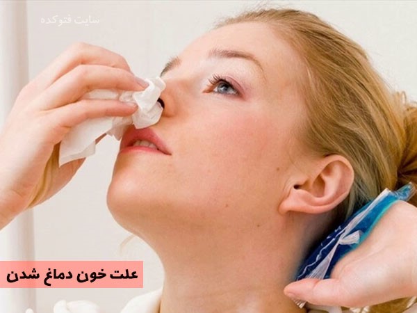 خونریزی دماغ نشانه چیست و روش های درمانی