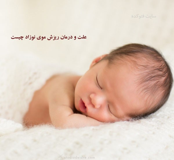 ریزش مو در نوزادان