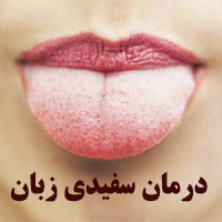 علت سفیدی زبان + 18 درمان سفیدی زبان با طب سنتی