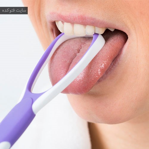 تراشیدن روی زبان برای درمان سفیدی زبان