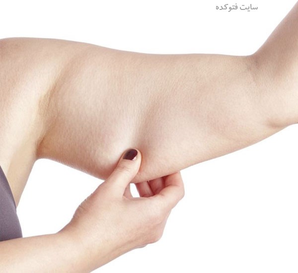 شل شدن عضلات شکم و بازو