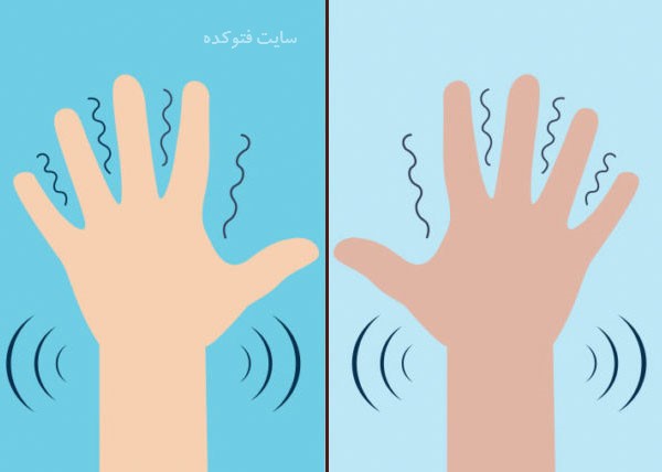 علل لرزش دست چپ و راست با عکس