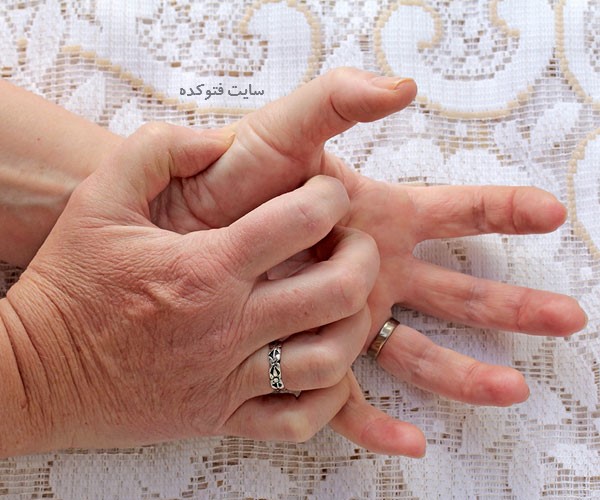 علل لرزش دست نشانه چیست با عکس