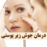علت و درمان جوش های زیر پوستی صورت و بدن