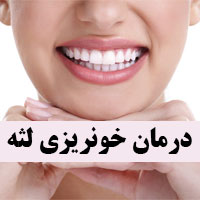 درمان خونریزی لثه در خانه با دارو و طب سنتی