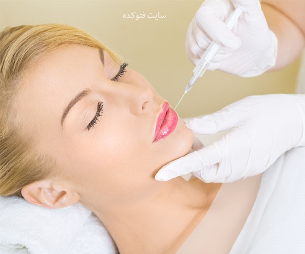 مراقبت های بعد از تزریق ژل