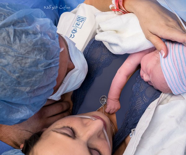 مراقبت بعد از جراحی سزارین در طب سنتی