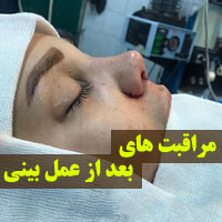 مراقبت های بعد از عمل بینی + ۲۷ توصیه بعد از جراحی بینی