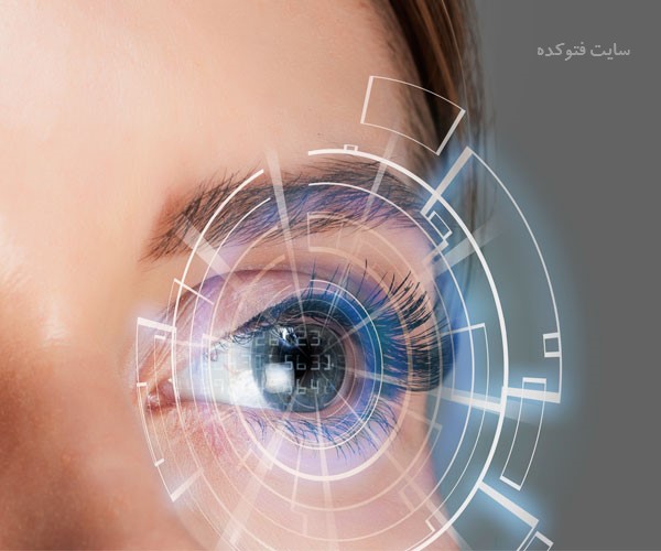 مراقبت های بعد از عمل لیزیک چشم