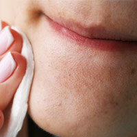 نحوه پاکسازی پوست و جلوگیری از مسدود شدن منافذ