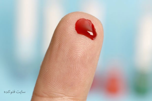علت پایین آمدن پلاکت خون
