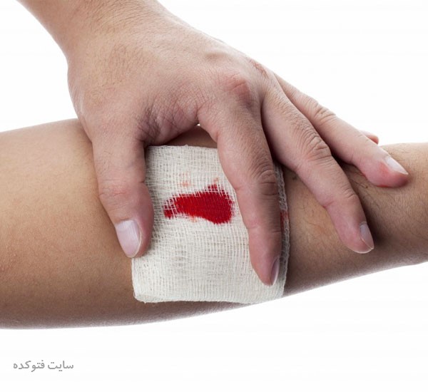 علت پایین آمدن پلاکت خون