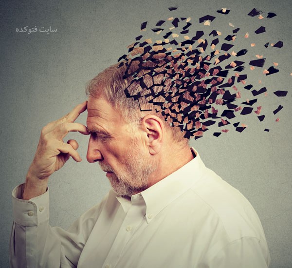پیشگیری از آلزایمر در جوانی
