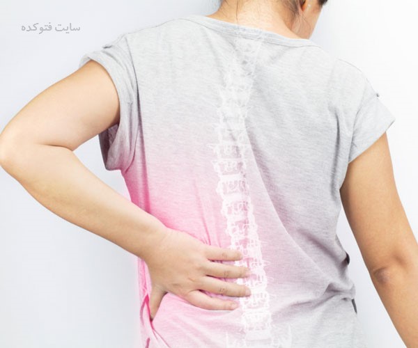 روش های جلوگیری از پوکی استخوان