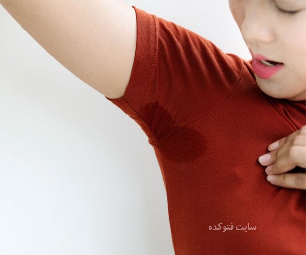 چرا زیاد عرق میکنم؟ با علت و درمان تعریق شدید