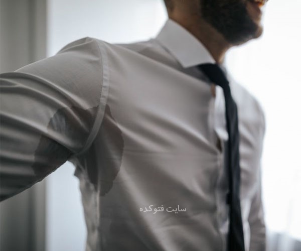 علت تعریق زیاد بدن نشانه چیست